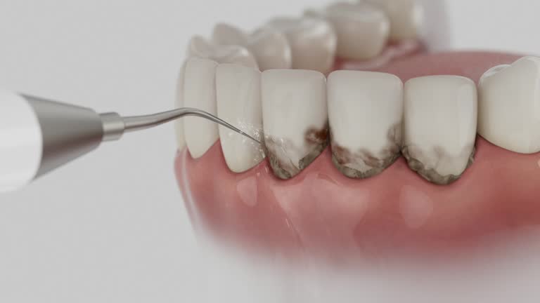 Trusted Teeth Cleaning And Checkup service in Davidson, NC - Dentist Open Now